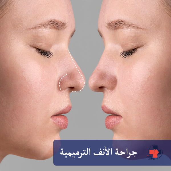 جراحة الأنف الترميمية
