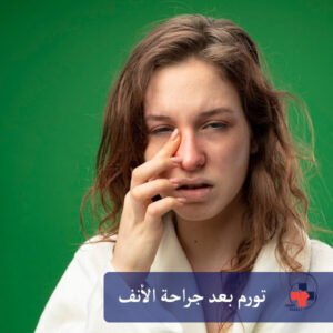 تورم بعد جراحة الأنف