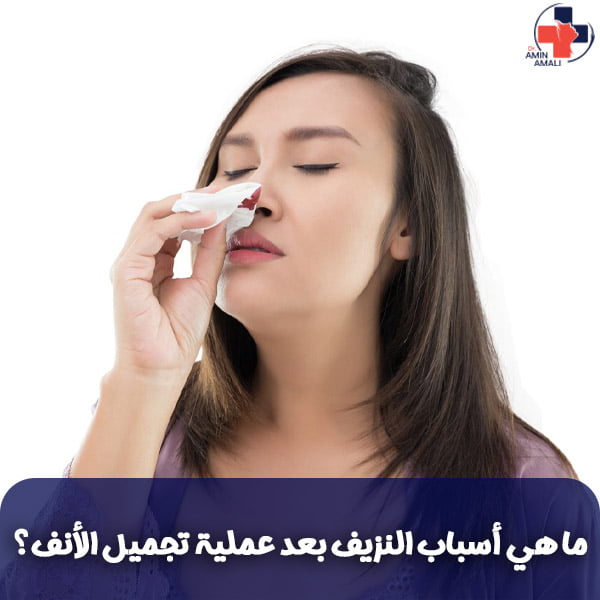 النزيف بعد من عملية تجميل الأنف
