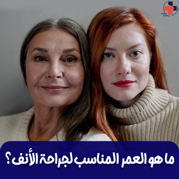 العمر المناسب لجراحة الأنف